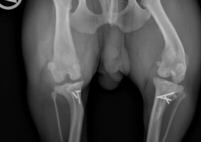 Patella Lux nach OP